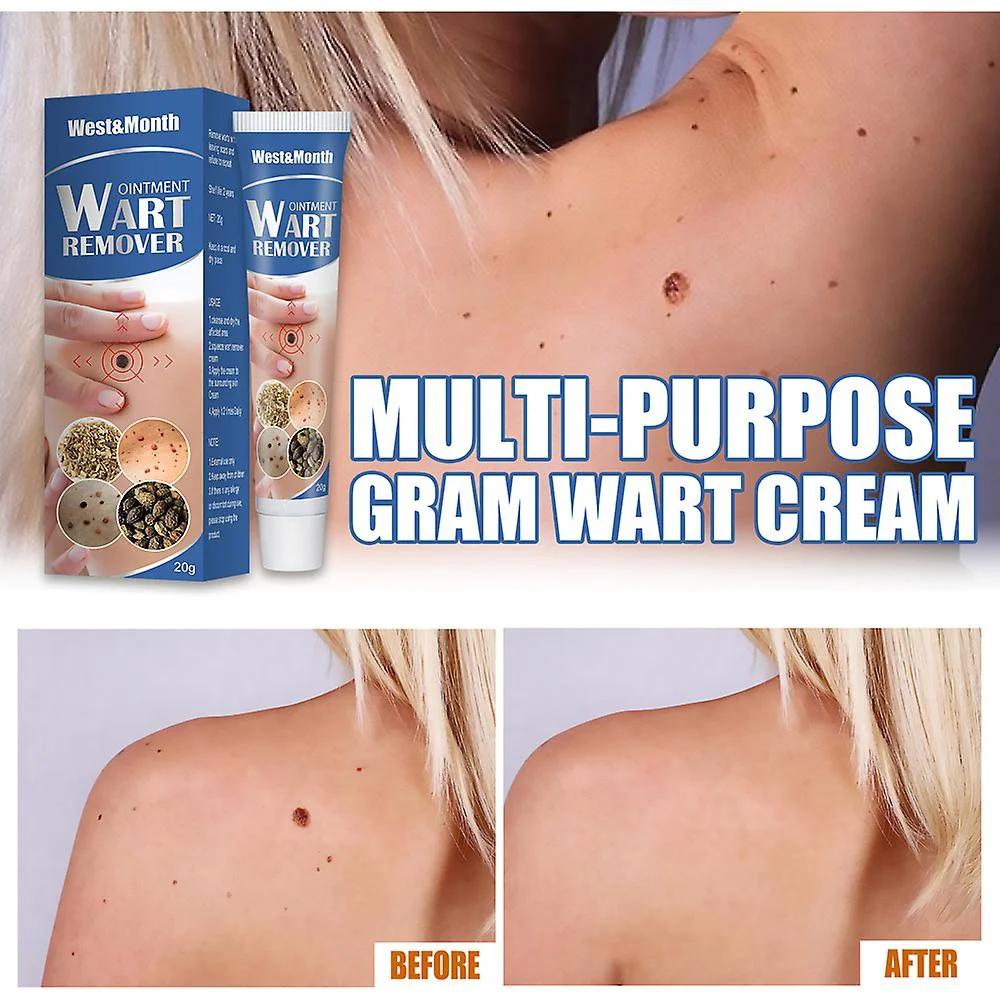 Crema Anti Verrugas